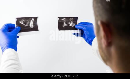 Échographie de la prostate dans les mains d'un médecin,pour faire un diagnostic, gros plan.démonstration de la maladie sur les images échographiques Banque D'Images