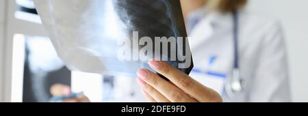 Les mains du médecin tiennent une radiographie dans le bureau médical. Banque D'Images