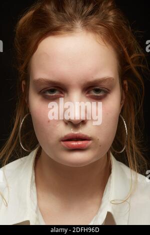 triste visage d'une fille froide avec une grippe avec un nez liquide et une température regarde l'appareil photo, gros plan portrait Banque D'Images