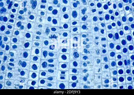 Division cellulaire dans les cellules de la pointe des racines de l'oignon, mitose, section colorée, photomicrographe à fond clair Banque D'Images