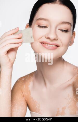 souriant jeune belle femme avec vitiligo utilisant gua sha isolé sur blanc Banque D'Images