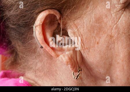 Appareil de prothèse auditive en oreille de femme senior - détail gros plan Banque D'Images