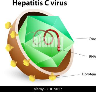 Virus de l'hépatite C. VHC. L'hépatite est une inflammation du foie qui peut être causée par un groupe de virus. Illustration de Vecteur