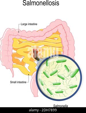 la salmonellose est une intoxication par la salmonelle à partir de poulet et d'œufs crus. intestins humains et bactérie qui causent cette maladie Illustration de Vecteur