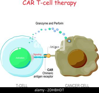 immunothérapie contre le cancer. Cellule T avec récepteur d'antigène chimérique (CELLULE t CAR) tuant la cellule tumorale. Thérapie biologique Illustration de Vecteur