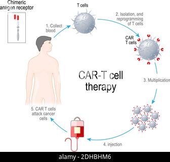 THÉRAPIE PAR lymphocytes T DE VOITURE. Les récepteurs des leucocytes artificiels sont des protéines qui ont été conçues pour l'immunothérapie contre le cancer (élimination des cellules tumorales) Illustration de Vecteur