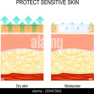 protéger la peau sensible. peau sèche et hydratant. Illustration de Vecteur