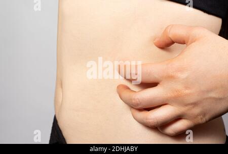 La femme égratignure la peau du côté de l'abdomen, la gale. Maladie contagieuse de la peau, dermatite et démangeaisons de la peau, gale Banque D'Images