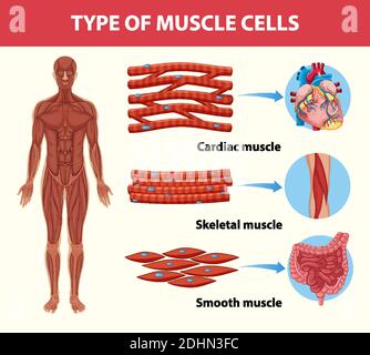 Type de cellules musculaires pour l'éducation à la santé Illustration infographique Illustration de Vecteur