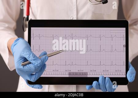 Médecin en gants de caoutchouc tenant un comprimé numérique avec un cardiogramme de gros plan Banque D'Images