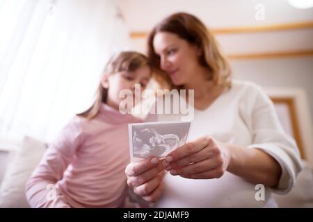 Vue rapprochée de la mise au point des mains pendant que la mère et la fille enceintes regardent l'image échographique du bébé. Banque D'Images