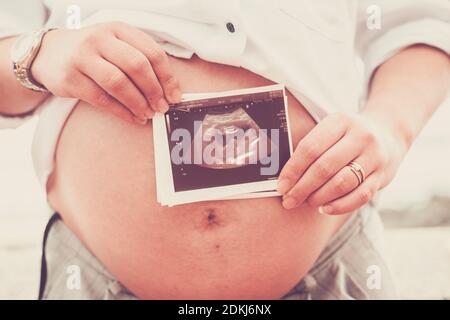 La jeune femme caucasienne montre sa photo de bébé à rayons X pour le nouveau-né et concept de personnes futures - femme enceinte portrait méconnaissable Banque D'Images