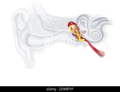 Illustration médicale montrant une inflammation de l'oreille moyenne, otite moyenne Banque D'Images