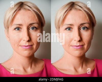 Ensemble de deux portraits de la même femme, l'un avant et l'autre après le traitement Banque D'Images