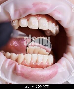 Marco instantané de la main du dentiste vérifiant les dents inférieures du patient à l'aide d'un miroir. Vue avant des belles dents blanches avec supports en céramique pendant la procédure dentaire. Enrouleur de joue sur les lèvres Banque D'Images