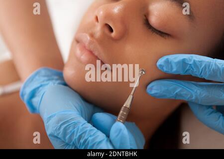 Gros plan sur une femme africaine magnifique atteinte de pores faciaux procédure de nettoyage à la clinique de beauté Banque D'Images