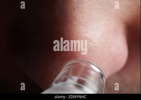 Blackhead skin treatment with cosmetic suction tool macro close up view Banque D'Images