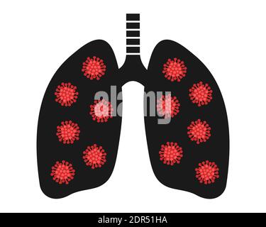 Pneumonie et cancer du poumon - la maladie et la maladie endommagent l'organe interne du corps humain. Problème de santé basé sur l'infection, virus, bactéries, tumeur an Banque D'Images