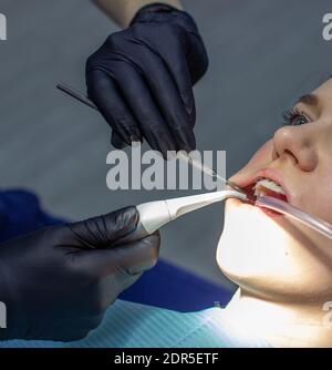 Une femme avec des bretelles dentaires visite un orthodontiste à la clinique. Dans la chaise dentaire pendant la procédure d'installation des bretelles sur la partie supérieure et inférieure Banque D'Images