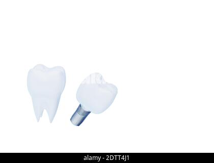 Couronne dentée et implant dentaire isolés sur blanc avec espace de copie, dent artificielle, rendu 3d Banque D'Images