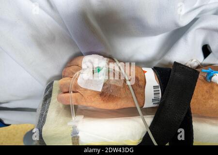 dans la main d'un patient opéré se trouve une canule veineuse pour perfusion Banque D'Images