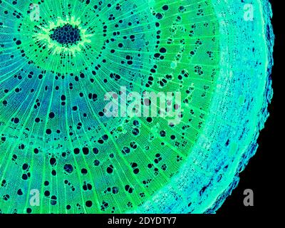 Tige Elm. Micrographe léger (LM) d'une coupe transversale à travers une tige ligneuse d'un arbre d'orme (Ulmus procera). Banque D'Images