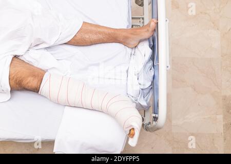 Patient allongé dans le lit d'hôpital avec une jambe cassée. Vue de dessus. Concept d'hospitalisation et de soins médicaux. Banque D'Images