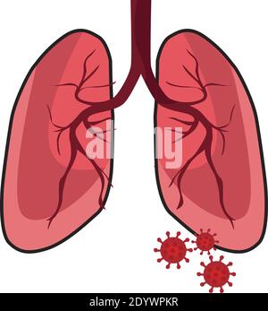 Poumons avec virus, illustration, vecteur sur fond blanc. Illustration de Vecteur