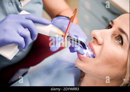 Gros plan des mains orthodontiques à l'aide d'un appareil à lumière ultraviolette dentaire lors de l'exécution d'une intervention dentaire en clinique. Femme avec des bretelles métalliques filaires sur les dents recevant un traitement dentaire. Concept de la dentisterie Banque D'Images