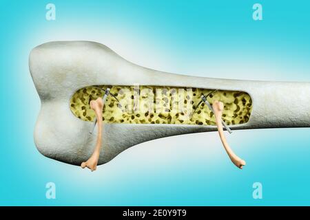 Gros plan des os des cuisses humaines essayant de résoudre le problème d'ostéoporose à l'intérieur de l'os des cuisses humaines sur fond bleu. . illustration 3d Banque D'Images