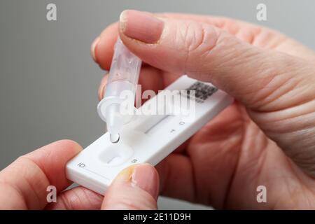 Test du coronavirus à l'aide d'un kit de test du dispositif de débit latéral. Banque D'Images