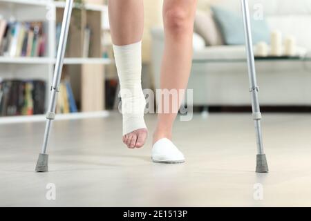 Vue de face rapprochée d'une femme handicapée qui marche avec béquilles et chevilles à bandage tentaculaire à la maison Banque D'Images