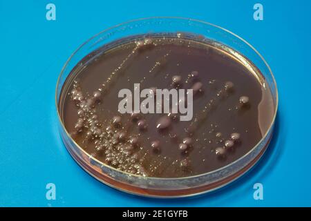 Colonies bactériennes sur une plaque de boîte de Petri de milieu de gélose avec de la gélose MacConkey Banque D'Images