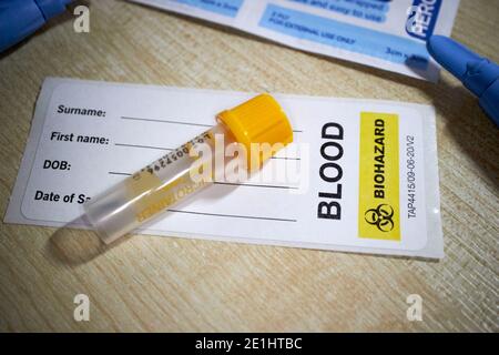 tube de prélèvement sanguin et étiquette de sang d'anticorps covid-19 commercial kit de test pour les tests à domicile des anticorps du coronavirus reçus dans le royaume-uni Banque D'Images