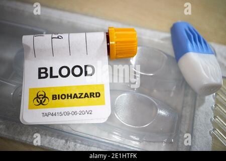 échantillon de sang étiqueté pour retour avec lancet utilisé dans le commerce kit de test sanguin d'anticorps covid-19 pour le dépistage à domicile du coronavirus anticorps reçus au royaume-uni Banque D'Images
