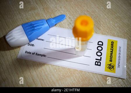 tube de prélèvement sanguin lancet et étiquette d'anticorps covid-19 du commerce kit de test sanguin pour le dépistage à domicile des anticorps du coronavirus reçus au royaume-uni Banque D'Images