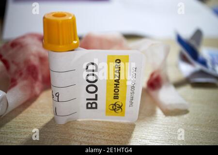 tube de prélèvement sanguin et étiquette de sang d'anticorps covid-19 commercial kit de test pour les tests à domicile des anticorps du coronavirus reçus dans le royaume-uni avec des tissus colorés de sang en arrière-plan Banque D'Images