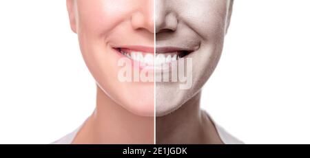 Le visage d'une femme est divisé en deux pour la bonne et la mauvaise peau. Isolé sur fond blanc Banque D'Images