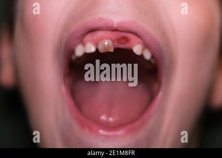 Petite Petite Petite Petite Bouche De Bebe Sans Dents Enfants Sante Soins Des Dents Dentisterie Photo Stock Alamy