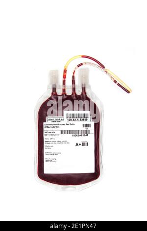 Sac de sang frais ou de globules rouges emballés, isolé sur fond blanc. Transfusion sanguine. Banque D'Images