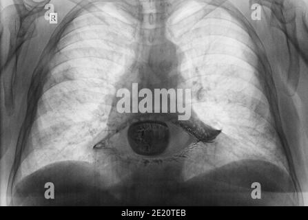 Image abstraite du troisième œil combinée à une radiographie du thorax comme expression, signe de l'âme humaine Banque D'Images