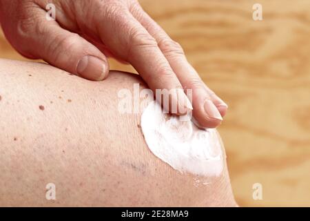 Une femme frotte une onguent de douleur sur son genou. Arthrose douloureuse du genou Banque D'Images