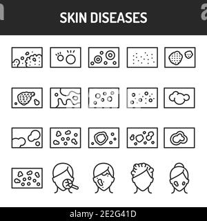 Icônes de la ligne noire des maladies de la peau définies. Elément vectoriel isolé. Pictogrammes de contour pour la page Web, l'application mobile, la promotion Illustration de Vecteur