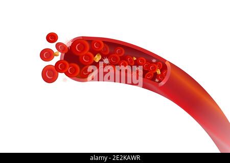 Artères saines avec érythrocytes rouges, illustration du concept de cholestérol élevé isolée sur blanc Illustration de Vecteur