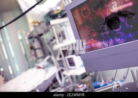 Concept de l'équipement technique moderne à la numérisation du cerveau endommagé. Banque D'Images