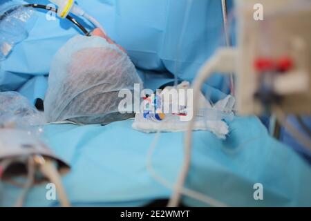 Patient sur la table pendant la chirurgie. Banque D'Images