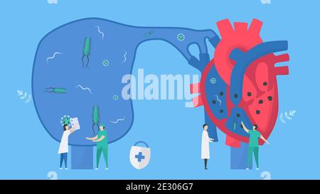 Illustration du vecteur cardiologique. Cette maladie appelle endocardite. C'est une infection de l'endocarde qui est des chambres et des valves cardiaques internes. Bactéries, par Illustration de Vecteur