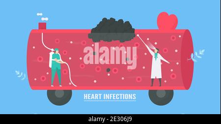 Illustration du vecteur cardiologique. Cette maladie appelle endocardite. C'est une infection de l'endocarde qui est des chambres et des valves cardiaques internes. Nœud d'Osler Illustration de Vecteur