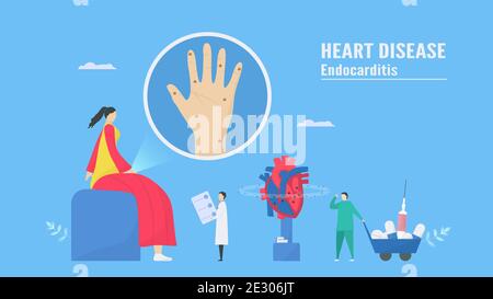 Illustration du vecteur cardiologique. Cette maladie appelle endocardite. C'est une infection de l'endocarde qui est des chambres et des valves cardiaques internes. Nœud d'Osler Illustration de Vecteur