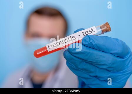Mains dans des gants médicaux tenant une fiole de sang pour un test d'hépatite. Le concept de la recherche et du développement médicaux. Banque D'Images